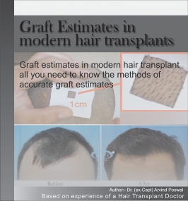 GRAFT ESTIMATES IN MODERN HAIR TRANSPLANTS