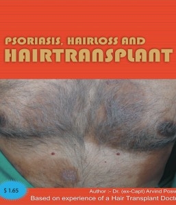 PSORIASIS, HAIR LOSS AND HAIR TRANSPLANT