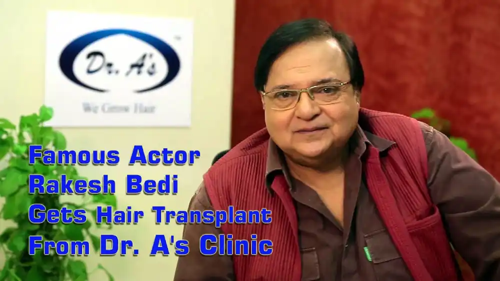 hair transplant in Delhi