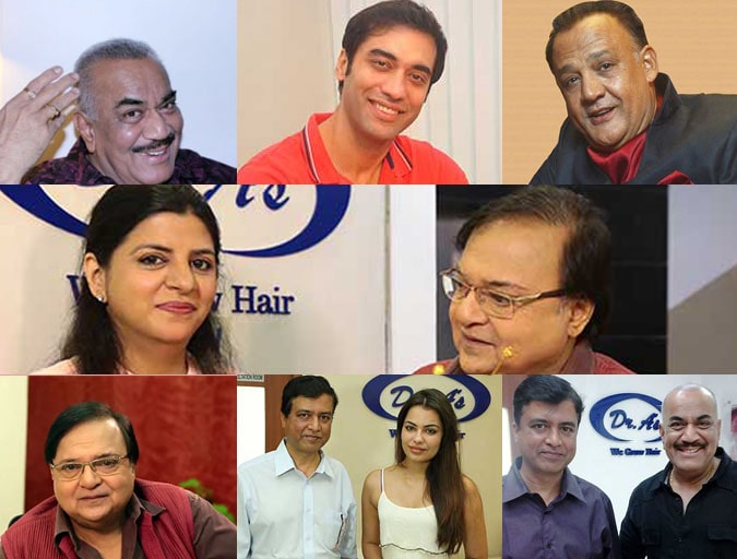 Bollywood Celebrities Hair Transplant