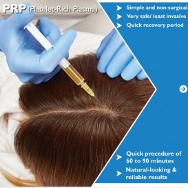 Best prp treatment in Delhi