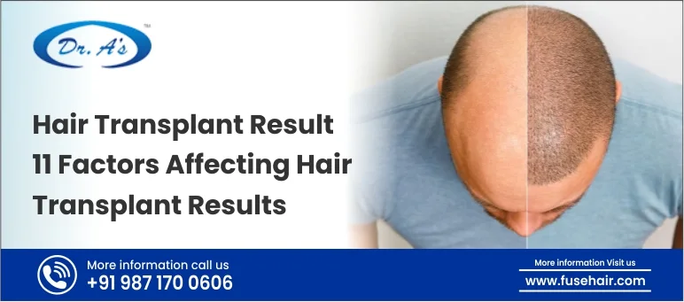 hair transplant results