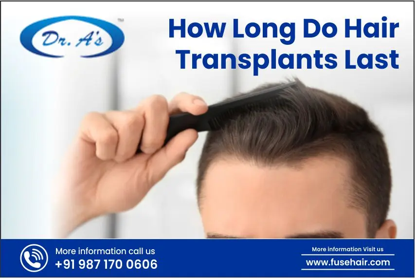 how long do hair transplant last