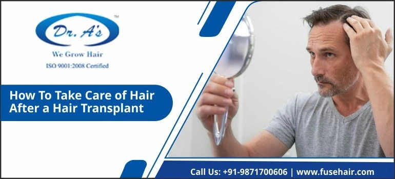 how to take care of hair after a hair transplant