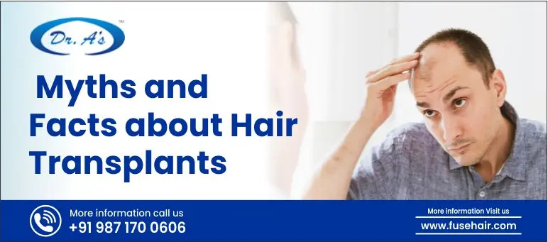 myths and facts about hair transplants