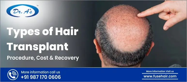 types of hair transplant procedure cost revocery