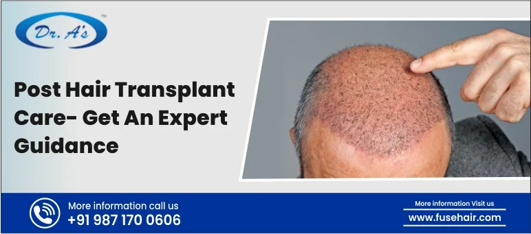 Post Hair Transplant Care