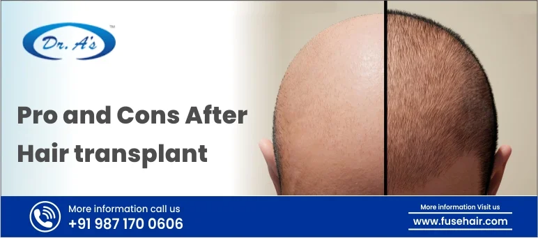 Pros and Cons After Hair transplant