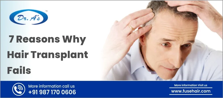 7 Reasons Why Hair Transplant Fails