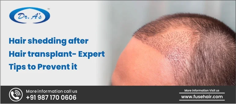 Hair Shedding After Hair Transplant