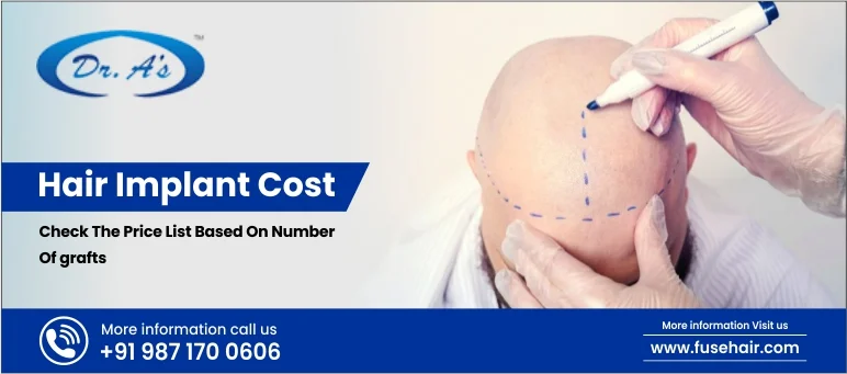 hair implant cost