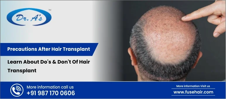 precaution after hair transplant