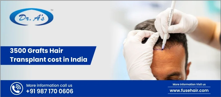 3500 Grafts Hair Transplant Cost in India