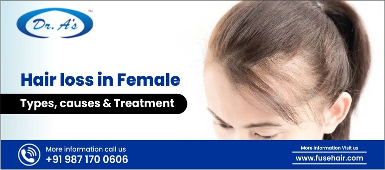 Hair loss in Females