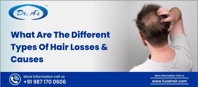 What Are The Different Types Of Hair Losses And Causes