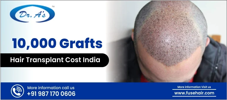 10,000 Grafts Hair Transplant Cost India