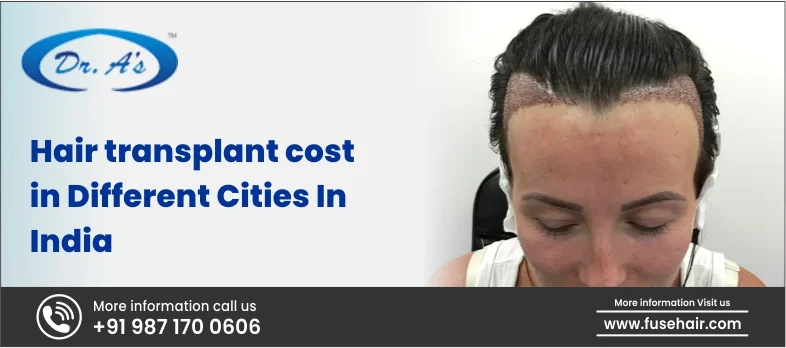Hair Transplant Cost in Different Cities In India