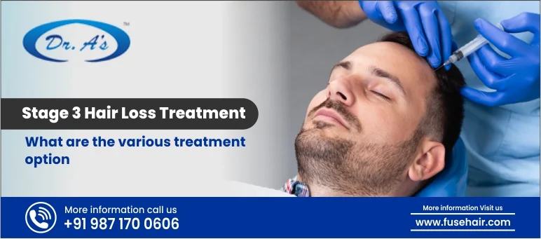 Stage 3 Hair Loss Treatment