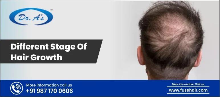 Different Stages Of Hair Growth