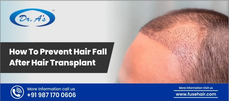 How to Prevent Hair Fall After Hair Transplant