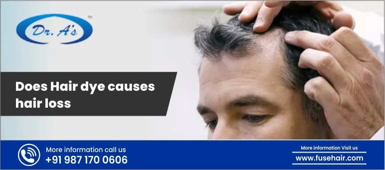 Does Hair dye causes hair loss