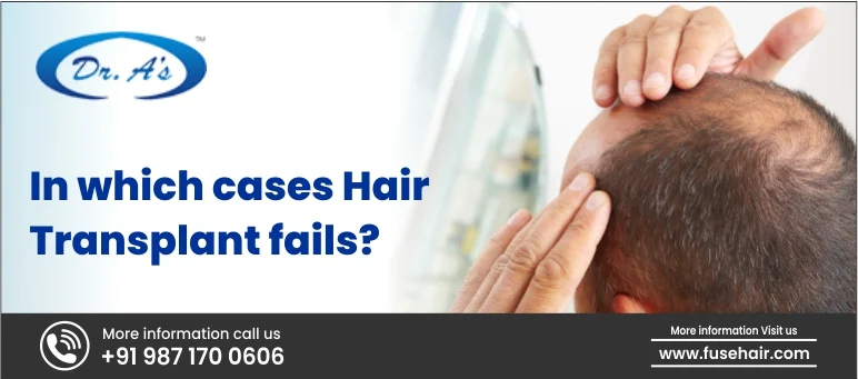 In which cases hair transplant fails?