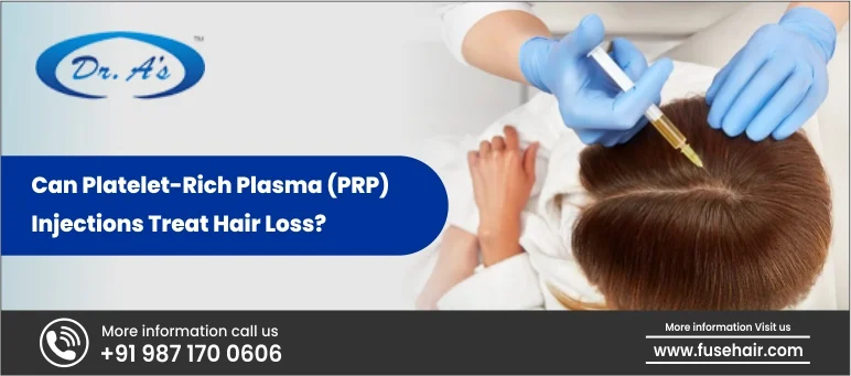 Can Platelet Rich Plasma (PRP) Injections Treat Hair Loss?