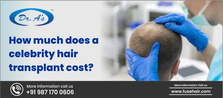 How much does a celebrity hair transplant cost?