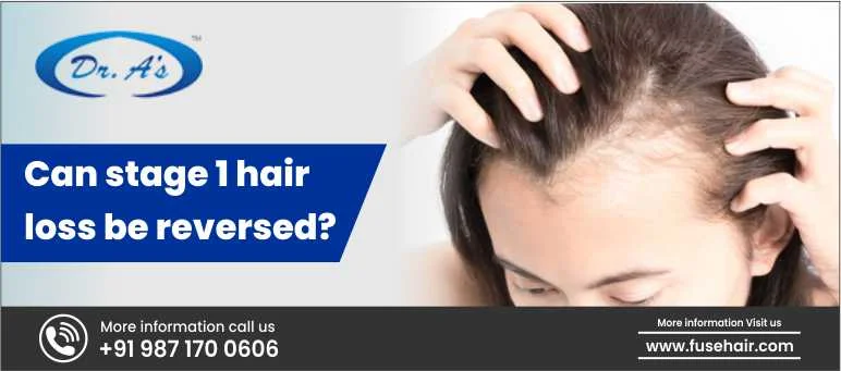 Can Stage 1 Hair Loss Be Reversed?