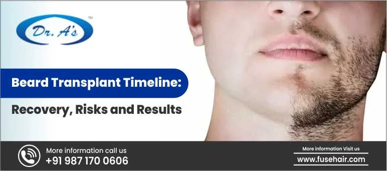Beard Transplant Timeline