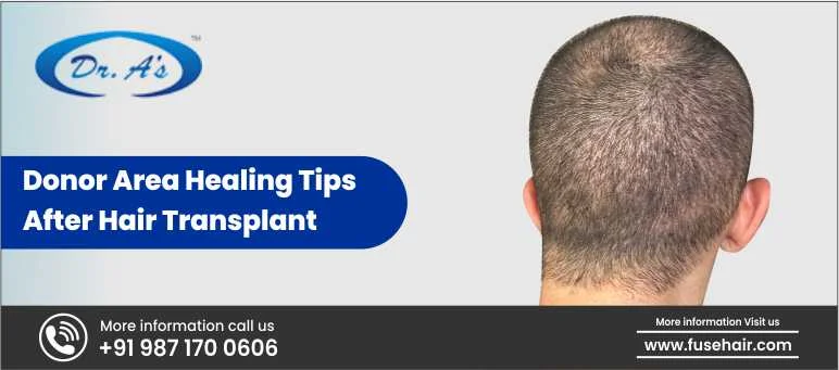 Donor Area Healing Tips After Hair Transplant