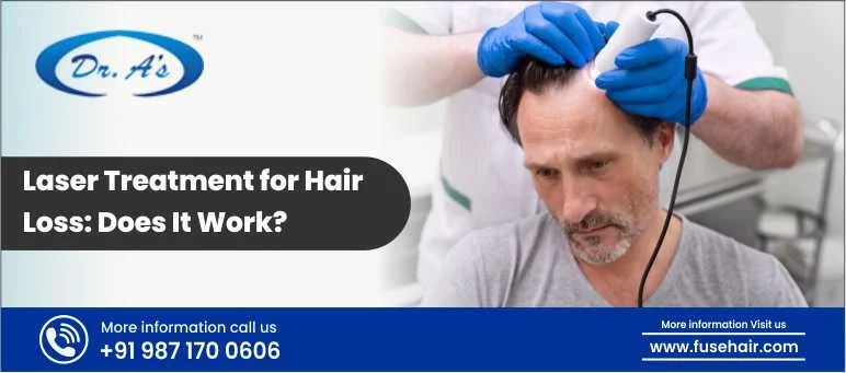 Laser Treatment for Hair Loss