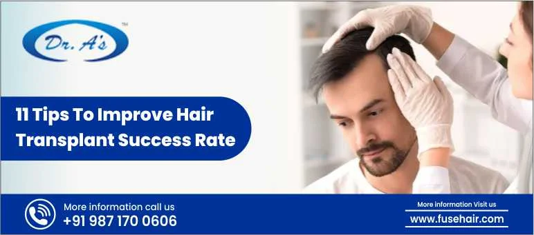 11 Tips to improve hair transplant success rate