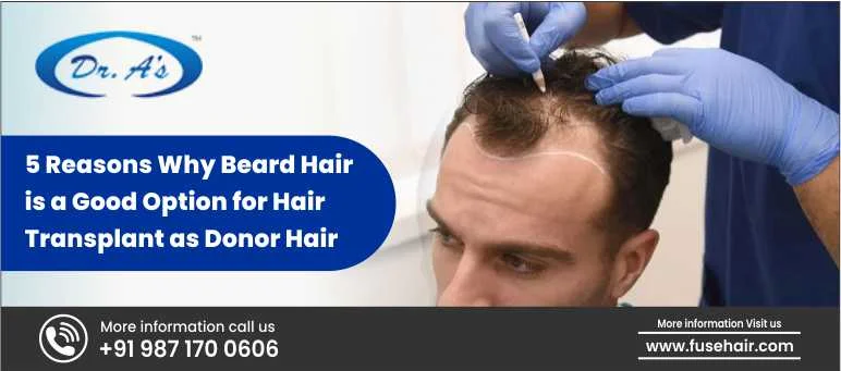 5 Reasons Why Beard Hair is a Good Option for Hair Transplant as Donor Hair Hair transplant techniques have evolved significantly over the years, providing hope for individuals struggling with baldness. One of the most innovative advancements in this field is the use of beard hair as a donor source for scalp transplants. Traditionally, scalp hair from the back and sides of the head has been used for transplantation. However, individuals with extensive baldness often face a major challenge: the limited availability of donor hair. As a perfect solution, Dr. Arvind Poswal has come up with an amazing technique for performing hair transplants with beard hair. Let us delve into this article to know more about this technique. Reasons Why Beard Hair is a Good Option for Hair Transplant as Donor Hair In 2006, Dr. Arvind Poswal made history by performing the world’s first beard-to-scalp hair transplant, offering a new avenue for patients seeking a fuller head of hair. Since then, this technique has gained widespread acceptance due to its remarkable benefits. Beard hair, being naturally strong, thick, and durable, serves as an excellent option for increasing scalp hair density and coverage. Here are the reasons why beard hair is a valuable donor source for hair transplants and how it can help individuals achieve optimal results. Stronger and Thicker Hair One of the primary reasons why beard hair is an excellent donor option is its natural thickness and strength. Compared to scalp hair, beard hair tends to be coarser, denser, and more robust. This characteristic is especially beneficial for individuals with advanced baldness, as thicker hair provides better scalp coverage and creates an illusion of higher density. When transplanted, beard hair enhances the overall volume of the scalp, giving a fuller and healthier look. Due to its resilience, beard hair also offers long-lasting results, making it an ideal choice for hair restoration. However, it is important to note that beard hair may not be suitable for the hairline, as its thickness can create an unnatural appearance in the frontal region. Instead, it is best utilized for mid-scalp and crown areas where additional density is required. Higher Growth Potential Another key advantage of using beard hair for scalp transplants is its impressive growth potential. Beard hair typically has a longer growth cycle compared to body hair, which means it continues to grow for an extended period before shedding. This characteristic makes it a reliable donor source for individuals who require a long-term solution to baldness. Additionally, beard hair has a higher survival rate post-transplantation. Due to its strong roots and genetic resistance to miniaturization (the process that leads to hair thinning), beard hair continues to grow healthily once transplanted onto the scalp. This ensures that the results of the procedure are not only effective but also sustainable over time. Increased Graft Availability One of the biggest challenges in hair transplantation is the limited supply of donor hair. Patients with severe baldness often have an insufficient number of scalp donor hairs to cover the entire bald area. In such cases, the availability of an alternative donor source is crucial. Beard hair provides an excellent solution by significantly expanding the donor pool. Many individuals have thick and dense beards, often extending to the neck and jawline. These surplus hairs can be utilized to supplement the available scalp donor hair, allowing for a greater number of grafts to be transplanted. This is particularly beneficial for individuals undergoing large-scale hair restoration procedures, where thousands of grafts are required to achieve the desired density. By incorporating beard hair into the transplant, surgeons can ensure a more comprehensive and effective coverage of bald areas, ultimately leading to better overall results. Better Coverage and Density One of the most significant advantages of beard hair transplants is their ability to provide superior coverage and density. Due to its coarse nature, beard hair occupies more space per follicle, contributing to a thicker and fuller look. This is especially useful for patients with extensive baldness, as it helps in achieving a more natural and voluminous appearance. When transplanted in combination with scalp hair, beard hair enhances the overall texture and density of the scalp. It can be strategically placed in areas that require more volume, such as the crown and mid-scalp regions. By increasing the number of grafts available for transplantation, beard hair ensures that even individuals with severe baldness can achieve satisfactory results. However, it is essential for the surgeon to carefully blend beard hair with scalp hair to avoid any noticeable differences in texture. With the right technique, beard hair can seamlessly integrate with existing scalp hair, resulting in a uniform and aesthetically pleasing outcome. Natural Blending with Scalp Hair A well-executed hair transplant should produce results that look as natural as possible. While beard hair is generally thicker than scalp hair, it can be skillfully blended to create a harmonious look. Experienced hair transplant surgeons use strategic placement techniques to ensure that beard hair integrates seamlessly with the existing scalp hair. For instance, beard hair is typically used in the mid-scalp and crown regions, where its thickness contributes to better coverage. It is rarely placed in the hairline, as the coarser texture might stand out. Instead, finer scalp hair is used in the frontal area to maintain a natural transition. To further enhance the blending process, surgeons often mix beard hair with scalp hair during transplantation. By distributing the follicles strategically, they create a balanced and realistic appearance that mimics natural hair growth patterns. This careful approach ensures that the final result is undetectable and aesthetically pleasing. Conclusion Beard hair transplants have revolutionized the field of hair restoration, offering a viable solution for individuals with extensive baldness. For those facing severe baldness and limited scalp donor hair, beard-to-scalp transplants provide an effective and long-lasting solution. However, the success of the procedure depends on the expertise of the surgeon and the careful planning of graft placement. If you are considering a hair transplant and have a strong beard donor area, consulting with Dr. Arvind Poswal at Dr. A’s Clinic can help you determine whether this technique is the right choice for you. With his decades of experience and the right approach, he will ensure that beard hair transplantation helps you achieve a fuller, healthier, and more natural-looking head of hair.