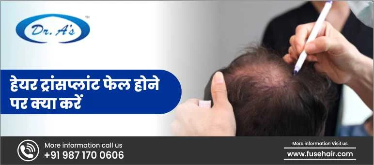 हेयर ट्रांसप्लांट फेल होने पर क्या करें