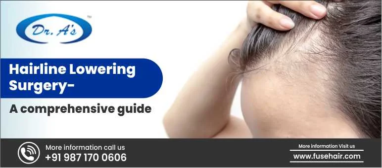 Hairline Lowering Surgery
