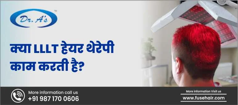 क्या LLLT हेयर थेरेपी काम करती है