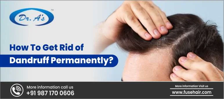 How To Get Rid Of Dandruff Permanently
