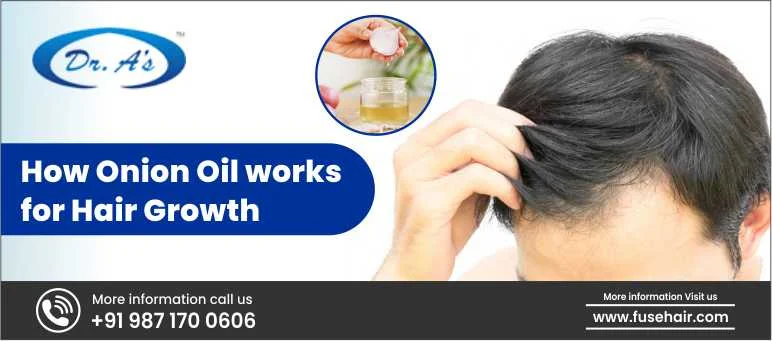 How Onion Oil works for Hair Growth