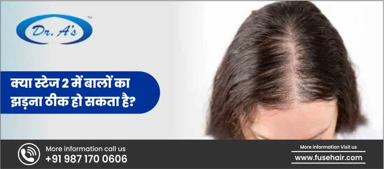 क्या स्टेज 2 में बालों का झड़ना ठीक हो सकता है?