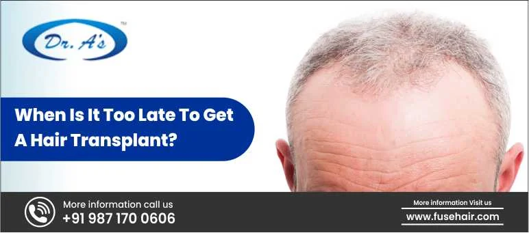 When Is It Too Late to Get a Hair Transplant?