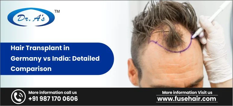 Hair Transplant In Germany Vs. India