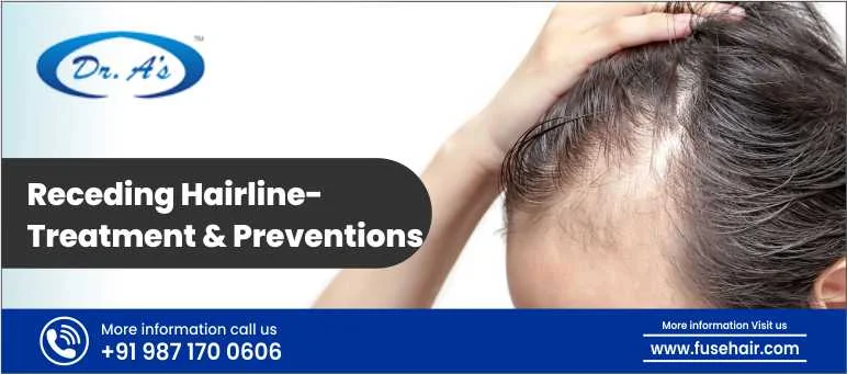 Receding Hairline