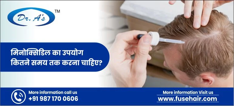 मिनोक्सिडिल का उपयोग कितने समय तक करना चाहिए?