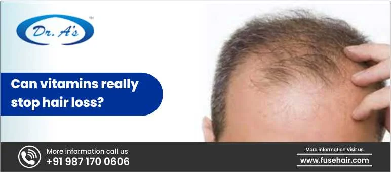 Can Vitamins Really Stop Hair Loss