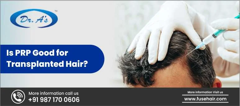 Is PRP Good For Transplanted Hair?