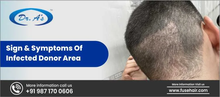 Sign & Symptoms Of Infected Donor Area