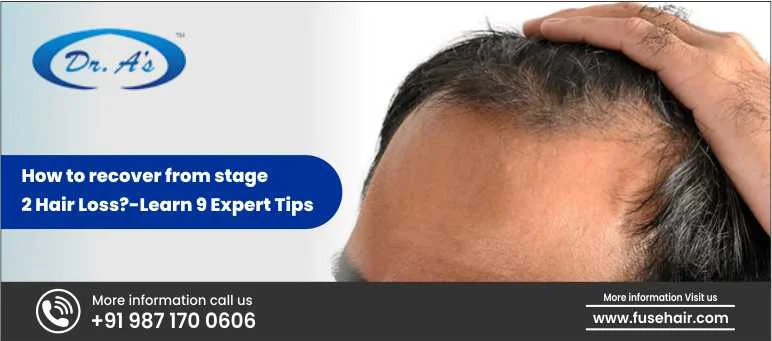 How To Recover From Stage 2 Hair Loss?