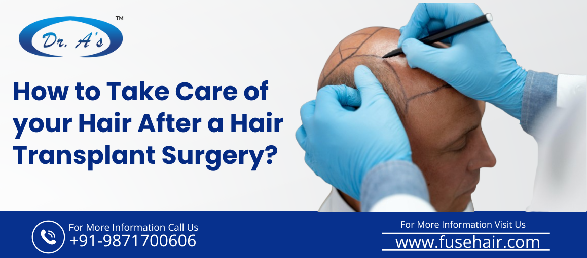 hair transplant surgery in india