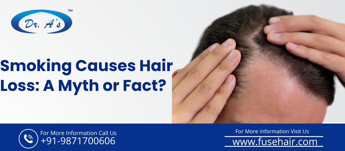 hair loss treatment cost in delhi